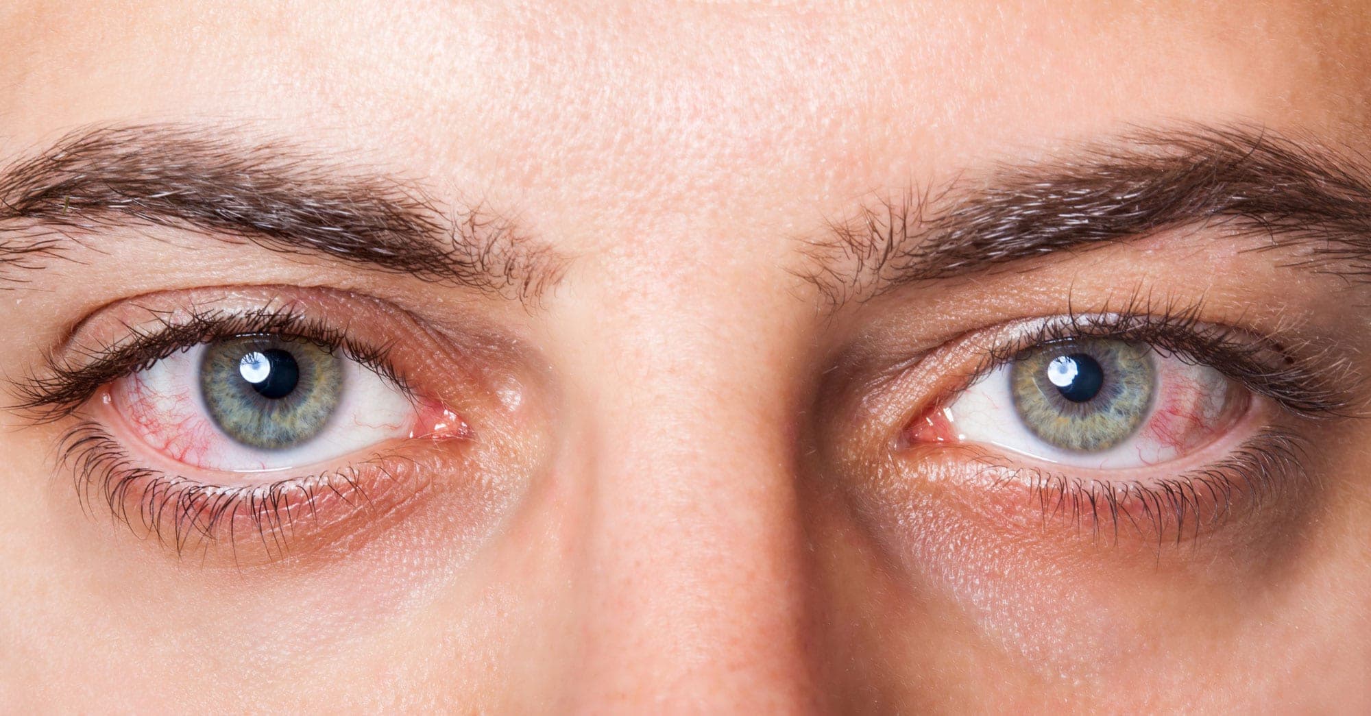 Dry eyes hero background